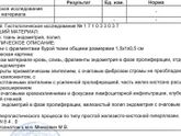 Гистология полипы,кто разбирается