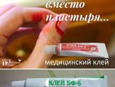 Порез ногтя на указательном, в комм-ах фото