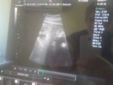 32,4 недели