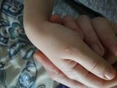 Что это может быть?прыщик будто водянистный