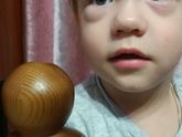 SOS!!!! Опух глаз