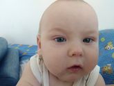 Видете сыпь??