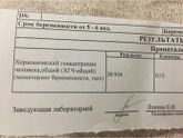 Хгч
