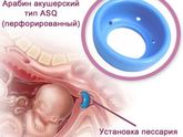 Ой девочки беда(((((
