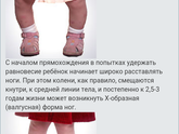 Про ортопедическую обувь.