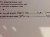 Была на УЗИ, сердечко урааа