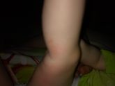 Девули, подскажите это аллергия?