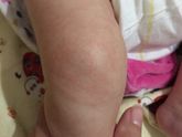 Девочки,у малой на коленках