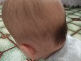Лысики ли у вас малыши на затылке?