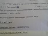 Узи 32 дпп