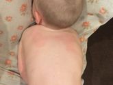 Непонятное покраснение