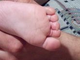 Пальцы облазиют, помогите!