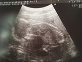 Это наш второй скрининг🏥🤰🏻сегодня