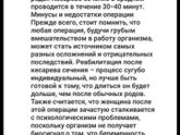 Кесарево или естественные роды