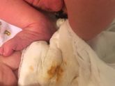 Рыжее выделение у мальчика