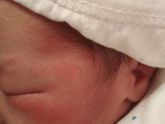 Диатез или потница? Два дня отроду.