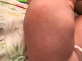 Шершавые очаги на логотках