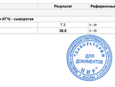 Анти-тела к хгч