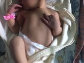 Анкета родов??