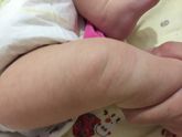 Девочки,у малой на коленках