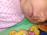 Что это такое? Может было у кого, родимое пятно что ли