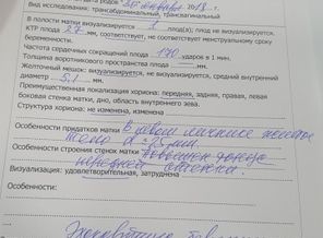 20170628_142752