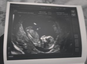 15108146859