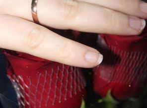 IMG_20180303_203736_3