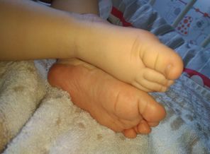IMG_20180314_155156
