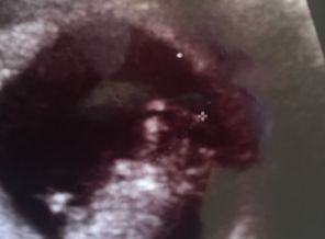 9BA6863D-74C7-4725-A3F8-AEBD6DC4DEC0.jpeg