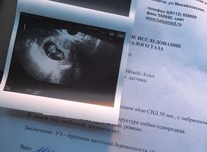 10 недель 3 дня ❤️