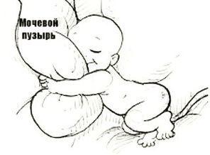 IMG_20171117_042812_785