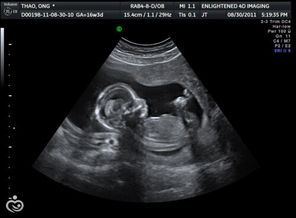 16-week-u