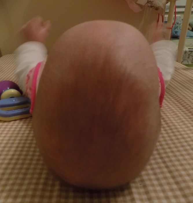 форма головы у ребенка