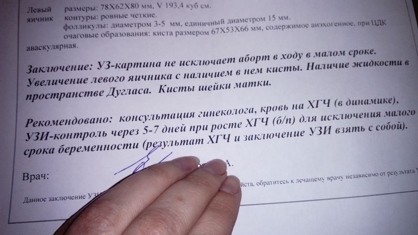 5 недель 3 дня, нет ПЯ