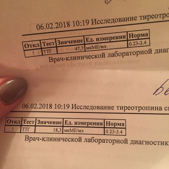 ТТГ