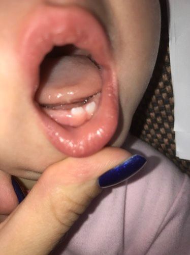 Зубы не по правилам 👀👶