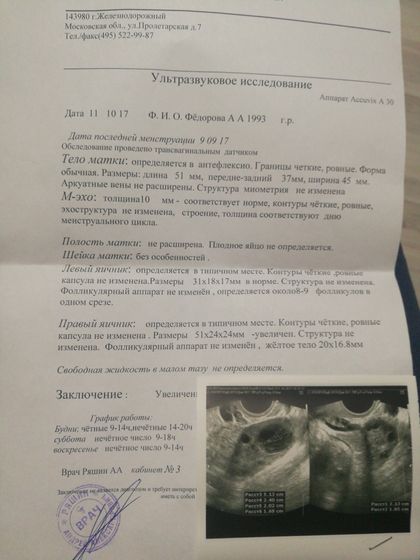 Сделала УЗИ малого таза