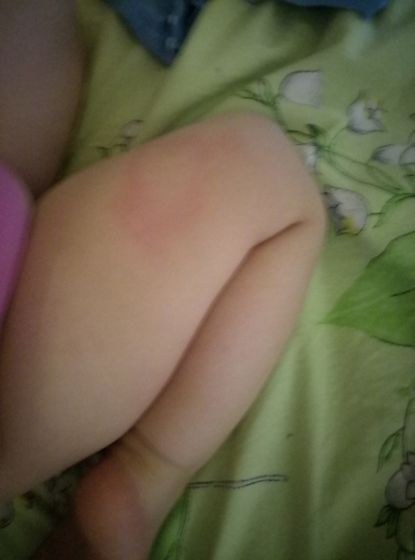 Сыпь куда звонить?