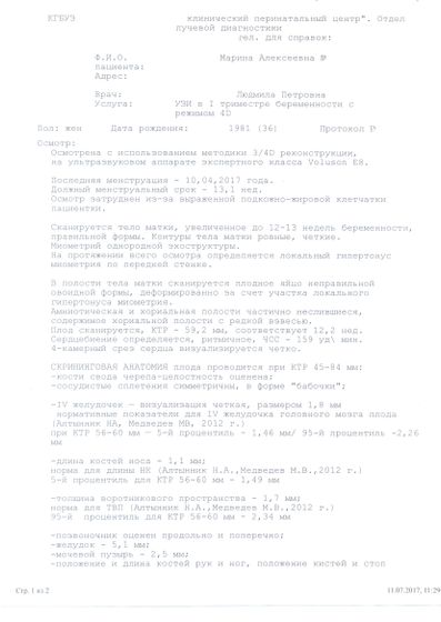 Риск по трисомии 21 рождения Дауна
