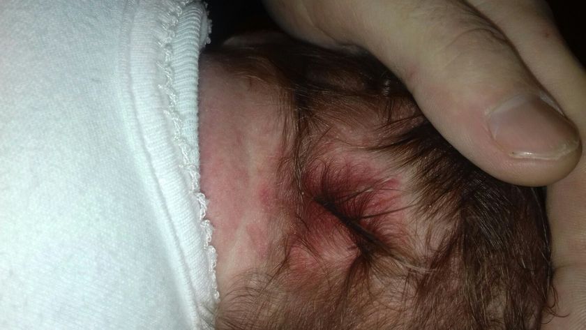 SOS! Аллергия?шелушения кожи?