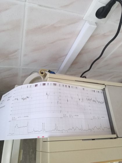 Роддом Тюмень на Доудельной