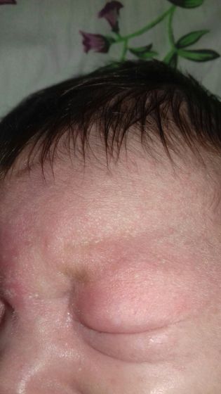 SOS! Аллергия?шелушения кожи?