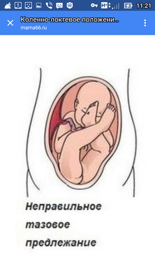 Коленно-локтевая поза) как правильно принимать его!Кому интересно, а то я очень долго искала эту инфу для себя))Может ещё кому-…