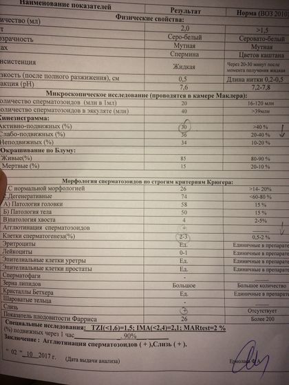 Варикоцеле