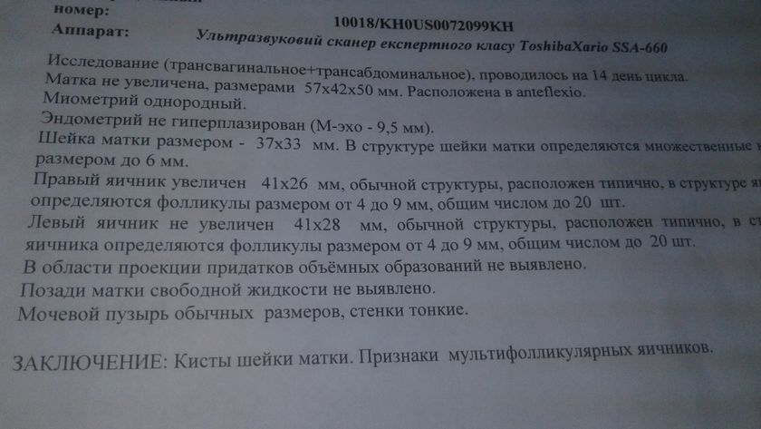 Мультифоликулярные яичники