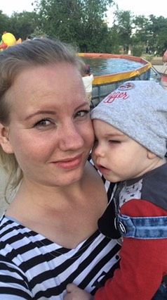 G80 ДЦП. Двойная гемиплегия. Вторичная микроцефалия. Симптоматическая эпилепсия. Задержка психомоторного развития. Поражение о…