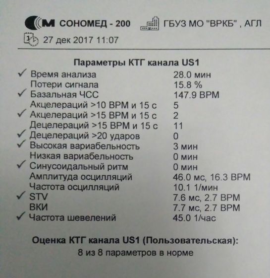 2ое КТГ в 34.6 недель 👶📈📉