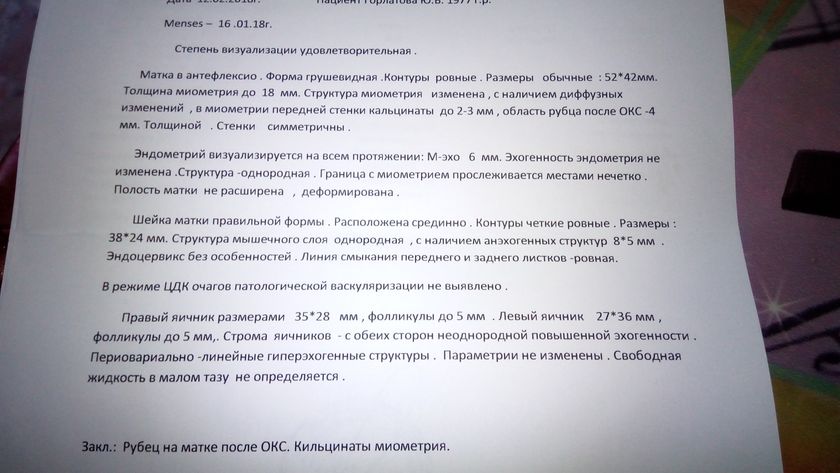 Кальцинаты миометрия!