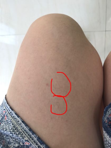 Сосуды или что это?!
